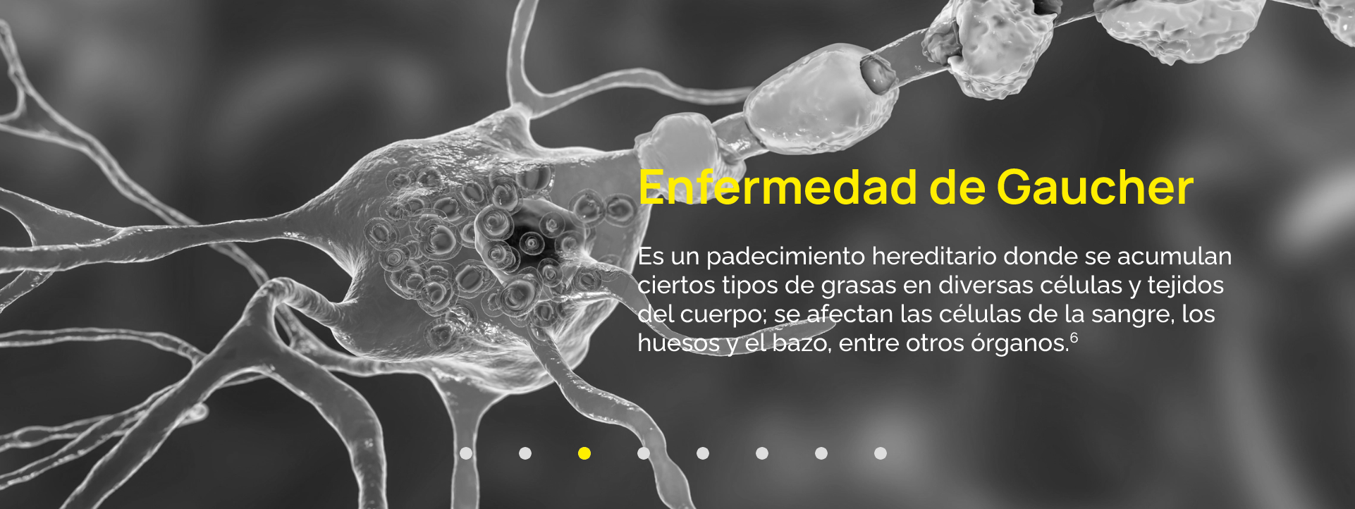 Es un padecimiento hereditario donde se acumulan ciertos tipos de grasas en diversas células y tejidos del cuerpo; se afectan las células de la sangre, los huesos y el bazo, entre otros órganos.6