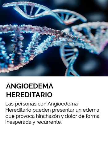 Las personas con Angioedema Hereditario pueden presentar un edema que provoca hinchazón y dolor de forma inesperada y recurrente.