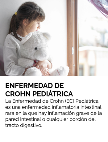 La Enfermedad de Crohn (EC) Pediátrica es una enfermedad inflamatoria intestinal rara en la que hay inflamación grave de la pared intestinal o cualquier porción del tracto digestivo.