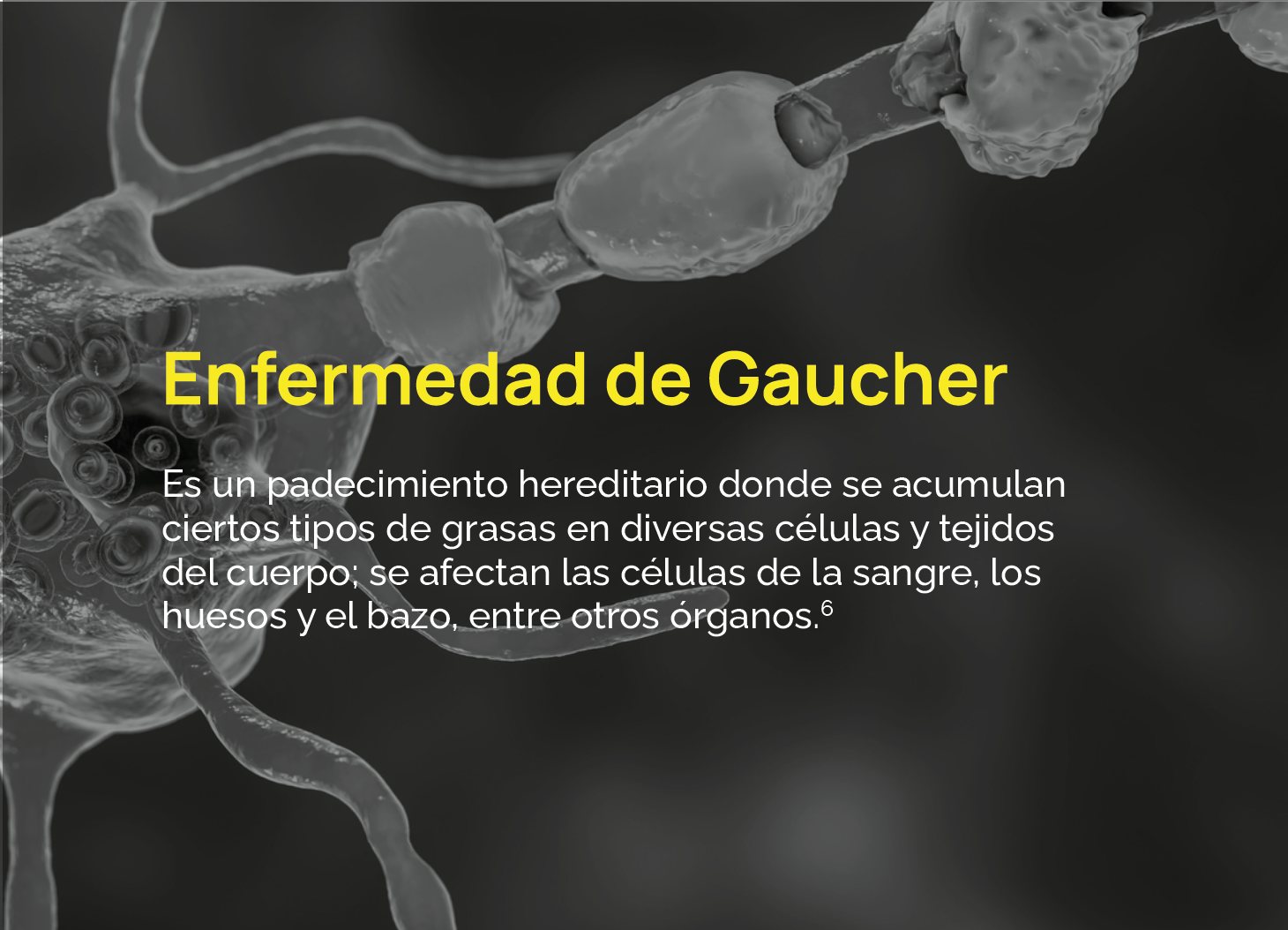 Es un padecimiento hereditario donde se acumulan ciertos tipos de grasas en diversas células y tejidos del cuerpo; se afectan las células de la sangre, los huesos y el bazo, entre otros órganos.6