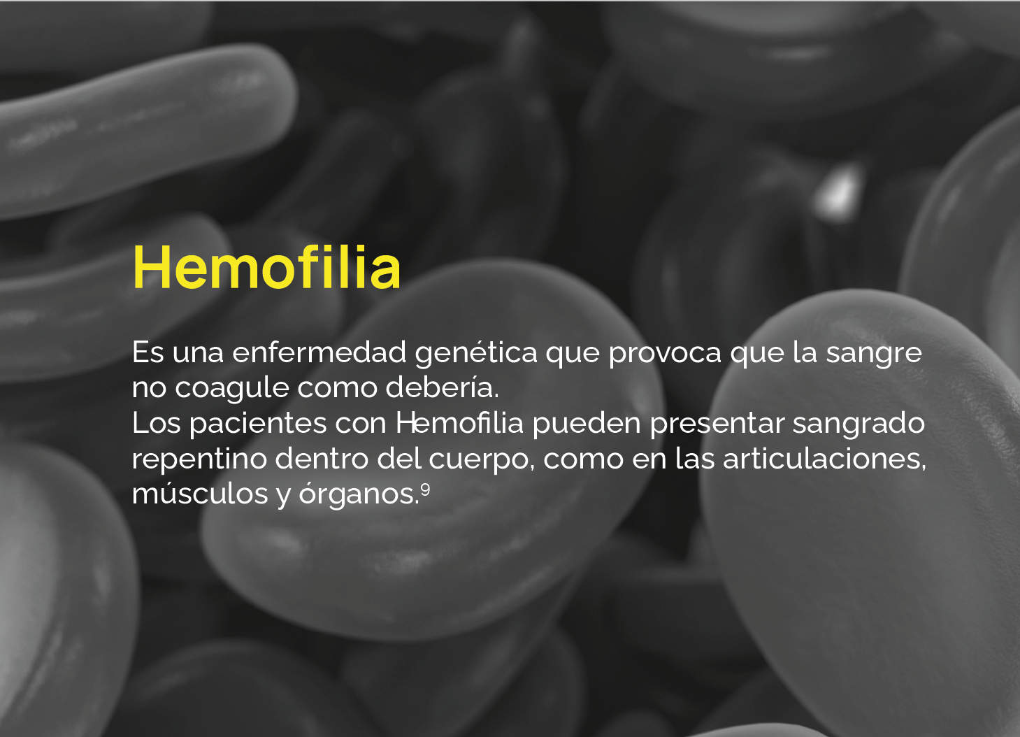 Es una enfermedad genética que provoca que la sangre no coagule como debería. Los pacientes con Hemofilia pueden presentar sangrado repentino dentro del cuerpo, como en las articulaciones, músculos y órganos.9